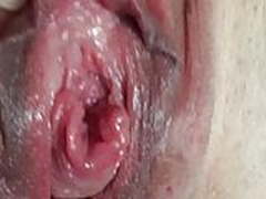 Urethra close up 