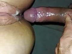 Gape anal